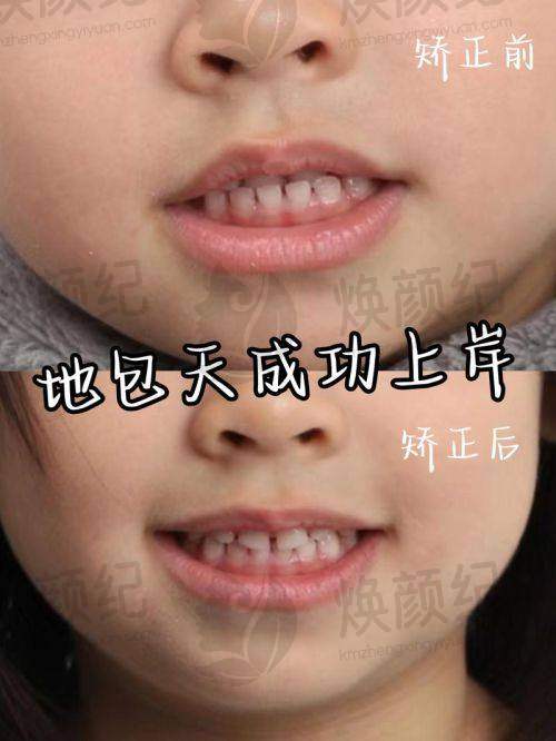 四、北京齐贝口腔(顺义建新西街店)设备介绍