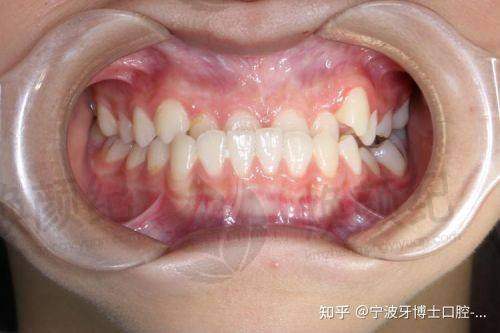 三、北京齐贝口腔(顺义建新西街店)核心科室与特色项目