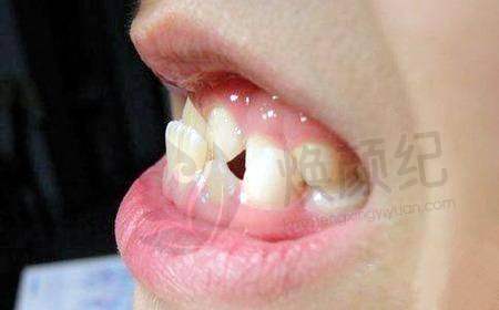 二、绍兴柯桥柯隆口腔医生团队，打造专精诊疗服务