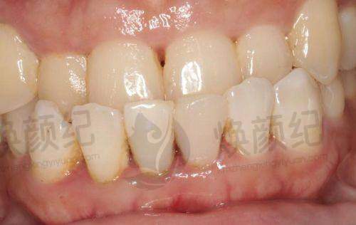 三、曹县芽美口腔医院核心科室与特色项目