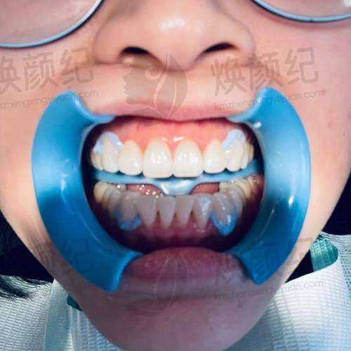 三、山东临沂兰山登超口腔诊所核心科室与特色项目