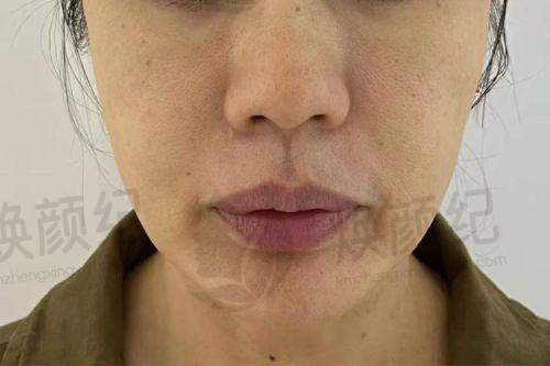 七、唐山依莱美整形医疗美容诊所就医指南，便捷就诊不迷路