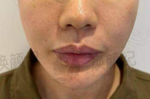 四、广州鹏爱医疗美容医院设备介绍