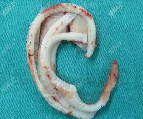 二、烟台毓璜顶医院烧伤美容整形中 心医生团队,打造专精诊疗服务