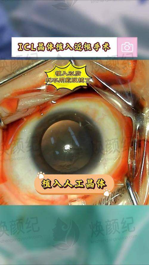 三、湘乡市人民医院眼科核心科室与特色项目