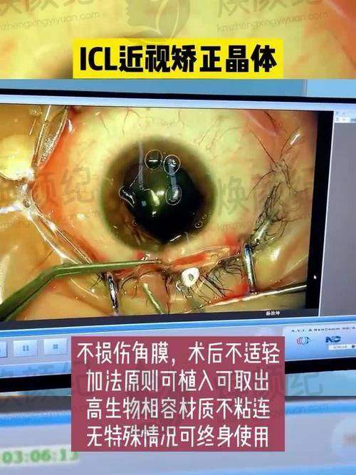 五、湘乡市人民医院眼科舒适就医环境,打造人性化诊疗体验