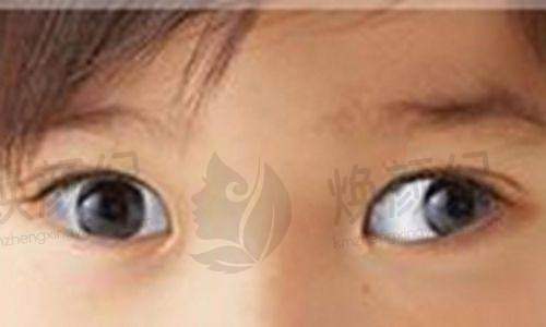 四、三六三医院眼科设备介绍