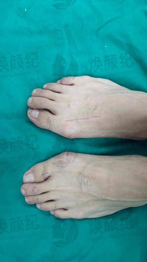 三、广州鹏爱医疗美容医院核心科室与特色项目