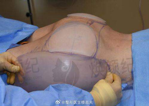 六、沈阳李铁民整形医疗美容诊所荣誉资质与患者口碑，见证品牌实力