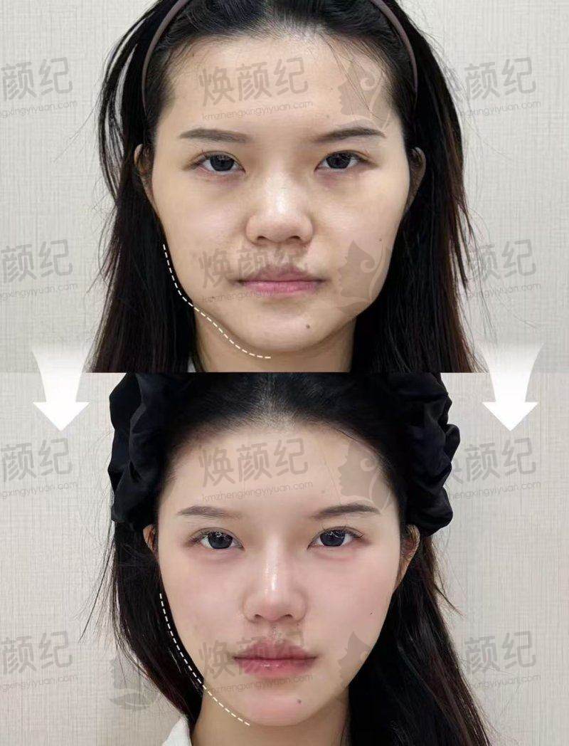 二、沈阳李铁民整形医疗美容诊所医生团队，打造专精诊疗服务