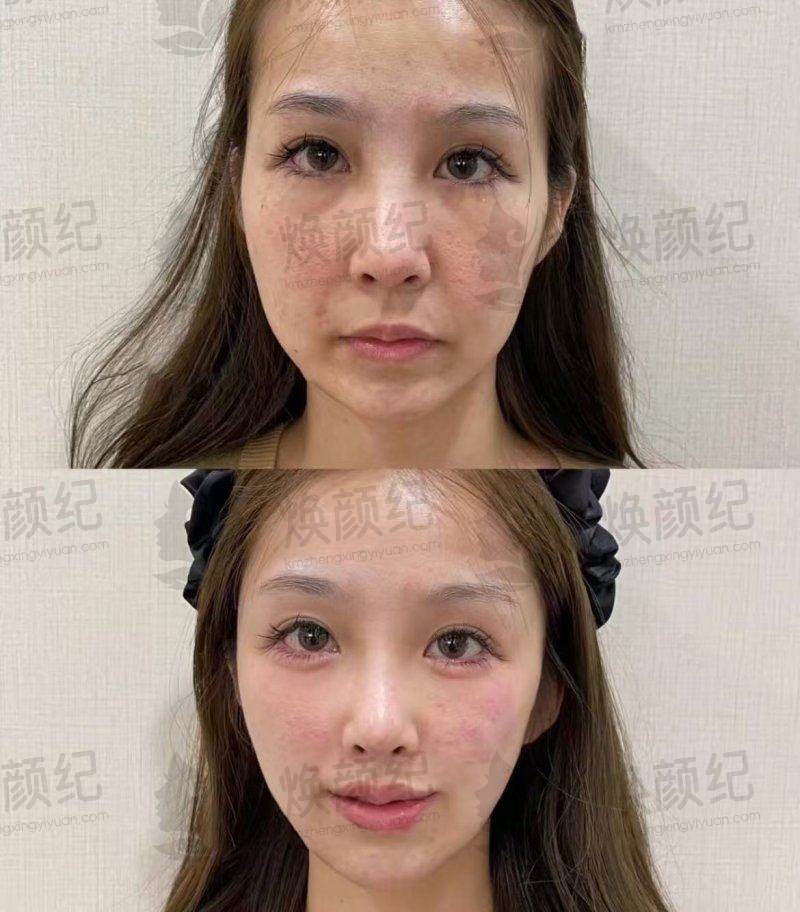 四、南宁市美丽在造医疗美容诊所设备介绍