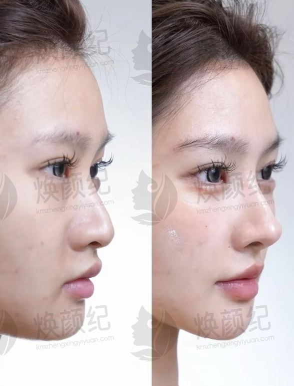 二、广州鹏爱医疗美容医院医生团队，打造专精诊疗服务