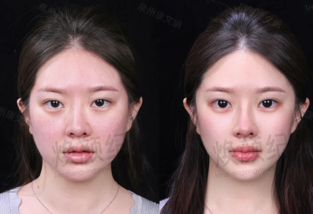 六、广州鹏爱医疗美容医院荣誉资质与患者口碑，见证品牌实力