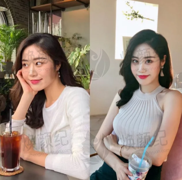 四、烟台毓璜顶医院烧伤美容整形中 心设备介绍