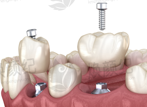 七、北京齐贝口腔(顺义建新西街店)就医指南，便捷就诊不迷路