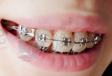 四、南京鑫美口腔设备介绍