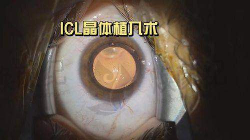 六、南方医 科 大学第三附属医院眼科荣誉资质与患者口碑，见证品牌实力