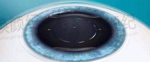 三、南方医 科 大学第三附属医院眼科核心科室与特色项目