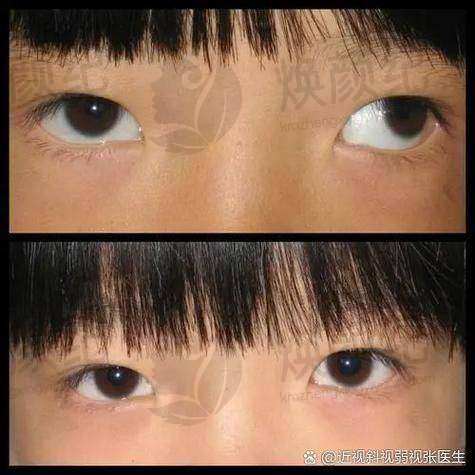 浙江省眼科医院富阳院区